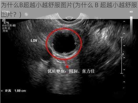 为什么B超越小越舒服图片(为什么 B 超越小越舒服图片?)