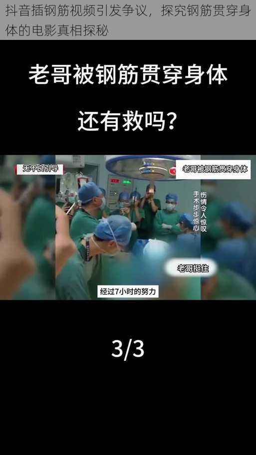 抖音插钢筋视频引发争议,探究钢筋贯穿身体的电影真相探秘